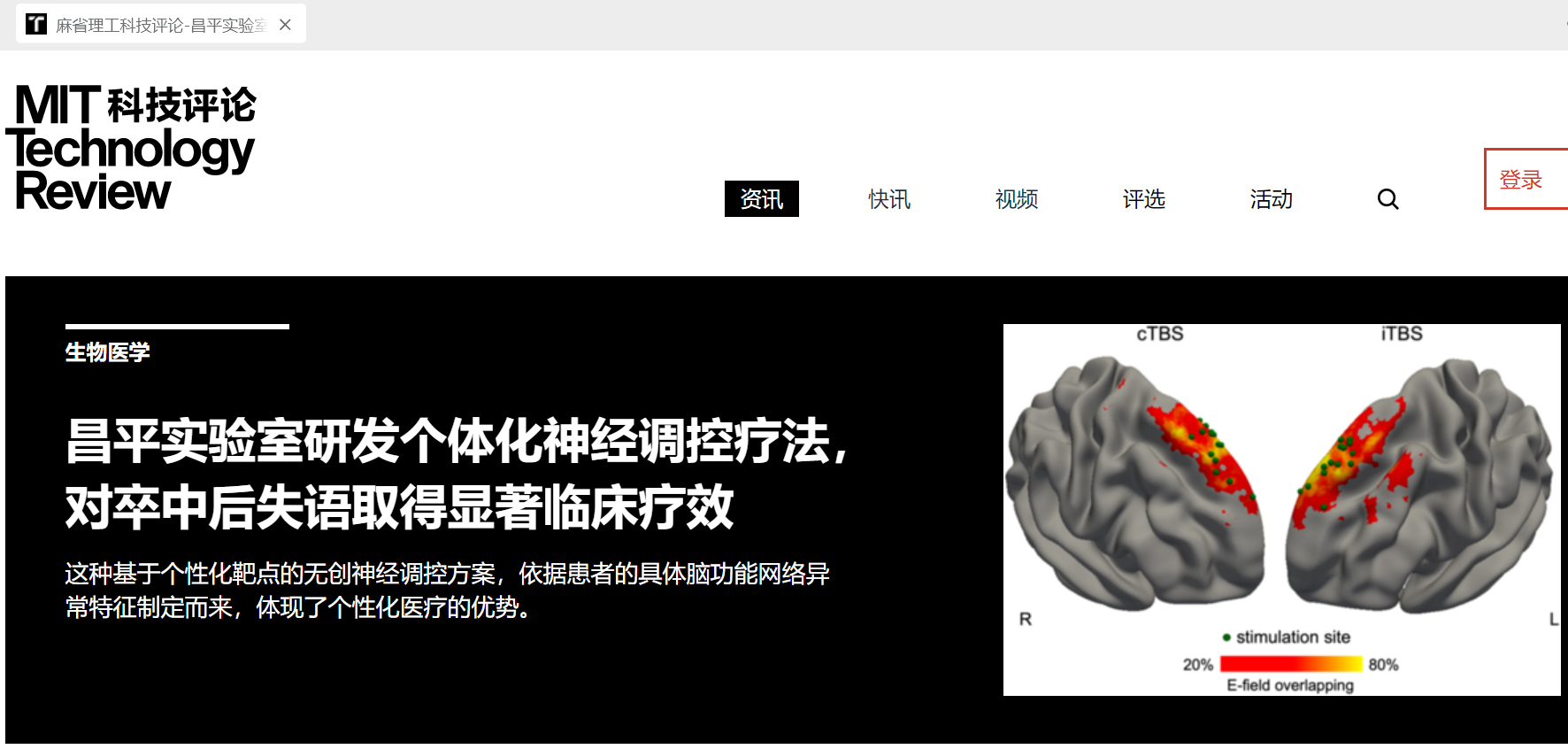 MIT科技评论：个体化神经调控疗法，对卒中后失语取得显著临床疗效