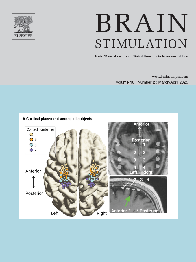 93%治疗响应率：个体脑功能剖分技术结合高剂量iTBS，破解卒中后三大功能障碍难题